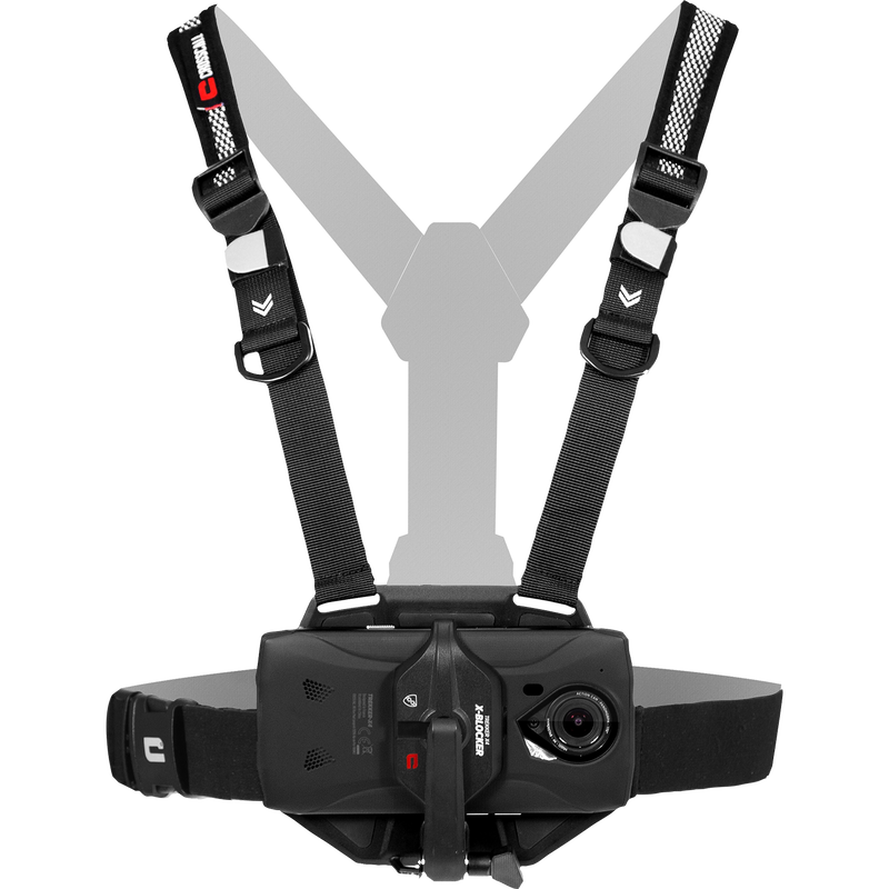 X-CHEST image number null